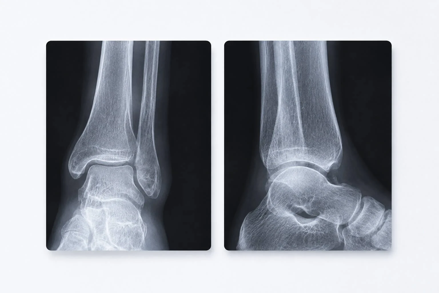 Radiografii medicale ale gleznei, exemplu de imagistică încărcată și asociată fișei pacientului în Evolvo.